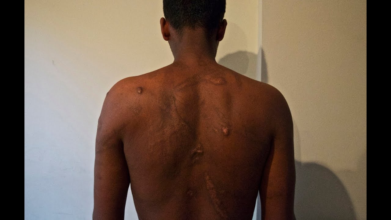 Sudan, Egypt: Traffickers Who Torture